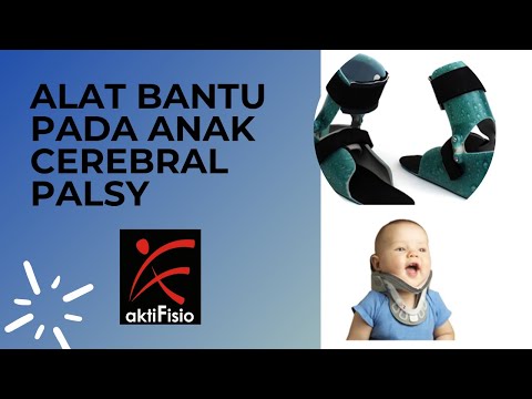 Video: Bagaimana Cara Mengikat Blackberry Dengan Benar? 17 Foto Jenis Penyangga Dan Instruksi Untuk Garter Pegas. Kapan Harus Mengangkatnya? Teralis Mana Yang Lebih Baik Untuk Digunakan?