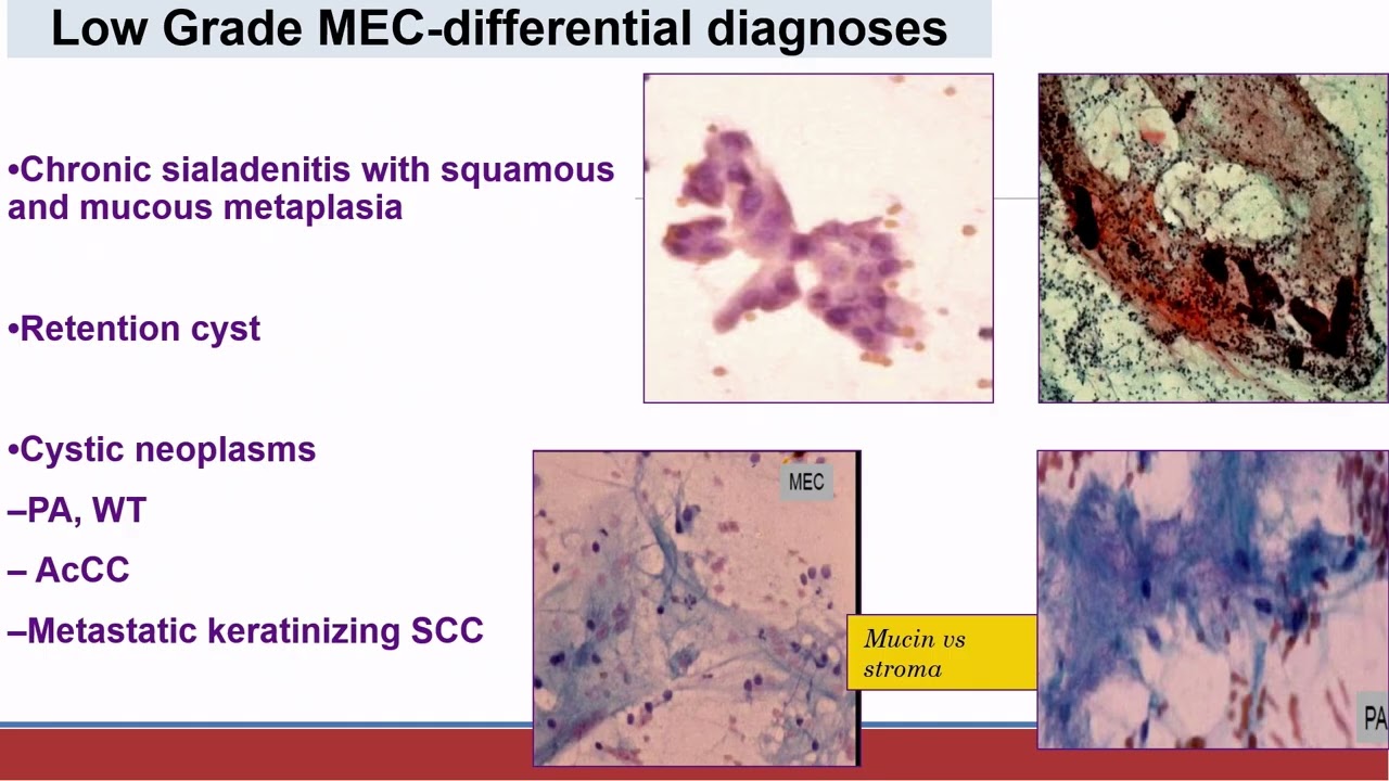 AP-IAP 2025,  Cytopathology, Diana Esther Rossi