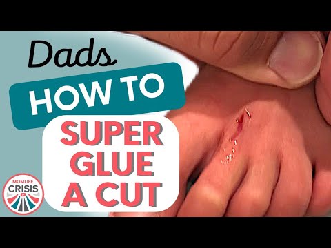 Wideo: Super Glue On Cuts: Kiedy I Dlaczego Go Używać