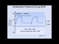 Non-Invasive Positive Pressure Ventilation (Mechanical Ventilation - Lecture 6)