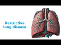 Enfermedades restrictivas pulmonares