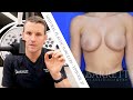 #27 Everything You Need to Know About Breast Lifts!