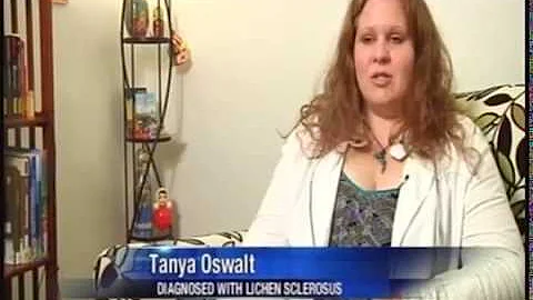 Lichen Sclerosus Diagnosis - Autoimmune Skin Disorder