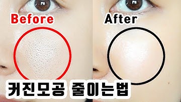 ENG)  커진 모공 작게 만드는 법! 드디어 공개! How to reduce your enlarged pores! | 뷰티클라우드 유나 UNA