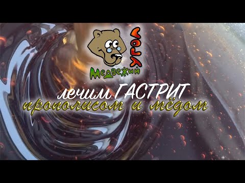 🍯🐝 лечим ГАСТРИТ прополисом и мёдом 🐝🍯