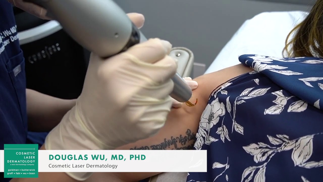 Banner for Safe & Effective Laser Tattoo Removal by a Board-Certified Dermatologist in San Diego, CA
