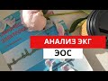 Анализ ЭКГ. Определение  ЭОС- электрической оси сердца. (для студентов)