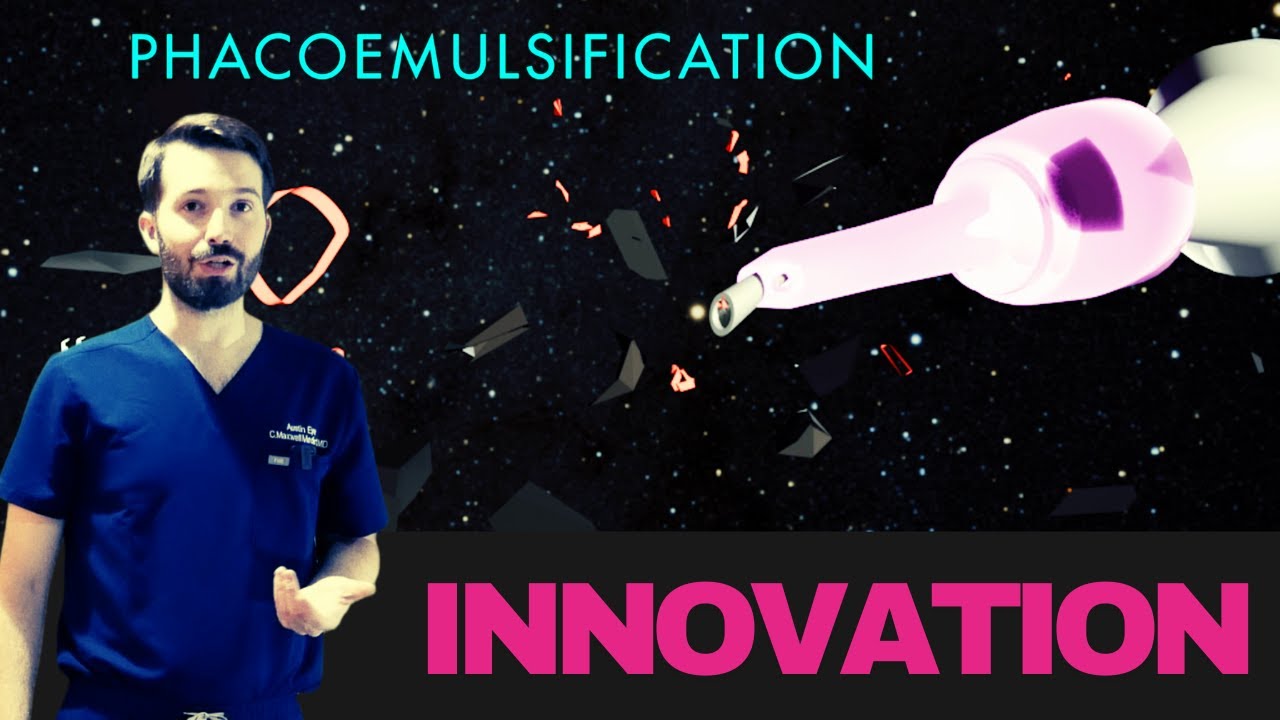 Cataract Surgery: Innovative Medicine