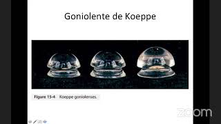 GLAUCOMA,  Describe and understand basic principles of Goldmann applanation tonometry.