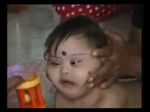 Downsyndrome Therapy - 2