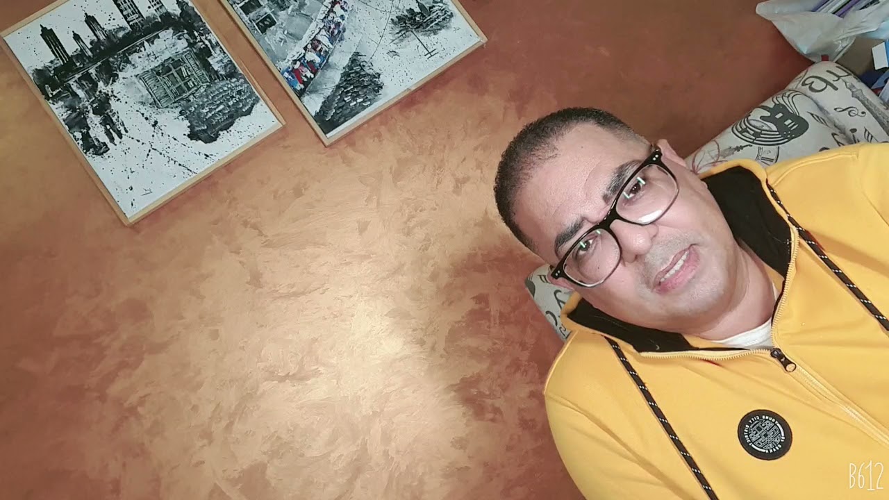 Tinnitus طنين الأذن الوش  الصفارة