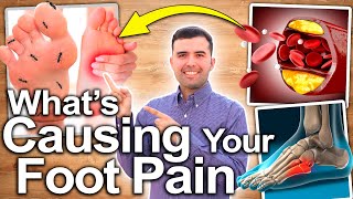 WHY DO YOUR FEET HURT - Top Causes For Foot and Leg Pain and How To Treat It Naturally