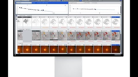 Video Tutorial Forum Glaucoma Workplace
