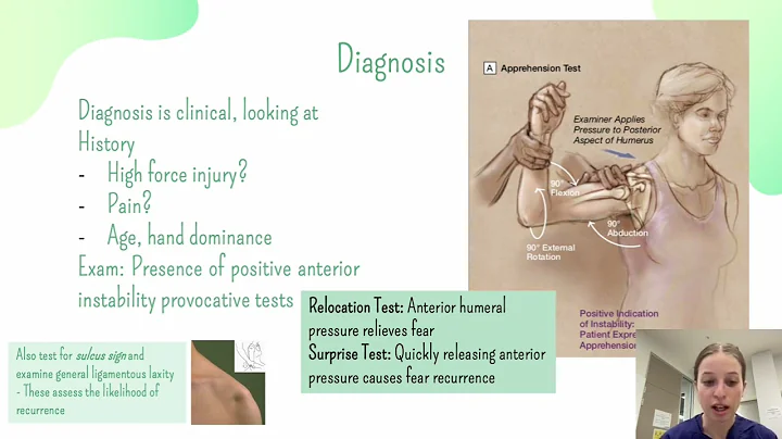 Shoulder Dislocation by Alison McKinnon