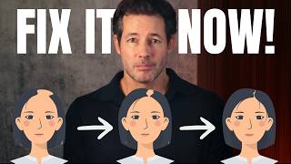 Female Hair Loss: The Causes and Treatments to Fix it!