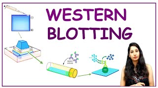 WESTERN BLOTTING I Protein Detection I Tools & Technique I Methods in Biology