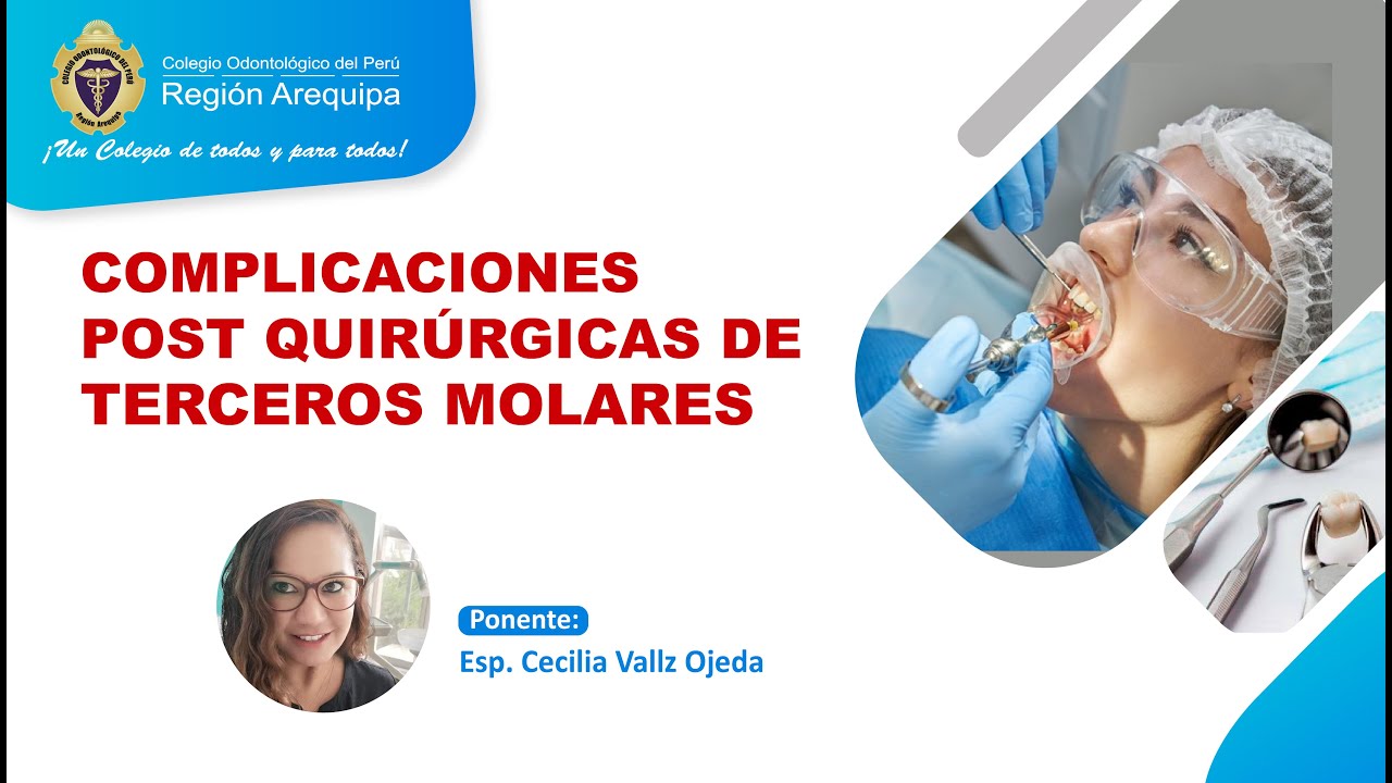 COMPLICACIONES DE TERCEROS MOLARES - YouTube