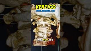 Vertigo Doctor Salt Lake City l NeckWise Upper Cervical Chiropractic
