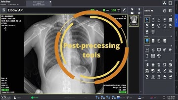 VXvue Quick Guide - Post Processing X-ray Image
