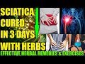 Herbal home remedies for sciatica natural treatment exercises causes of nerve pain  symptoms