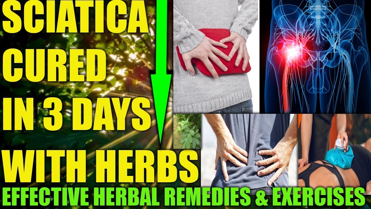 HERBAL HOME REMEDIES FOR SCIATICA NATURAL TREATMENT EXERCISES, CAUSES