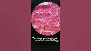 getting it on camera is an even tougher job🤕 #mbbs #medschool #histology #slides #microscope #patho