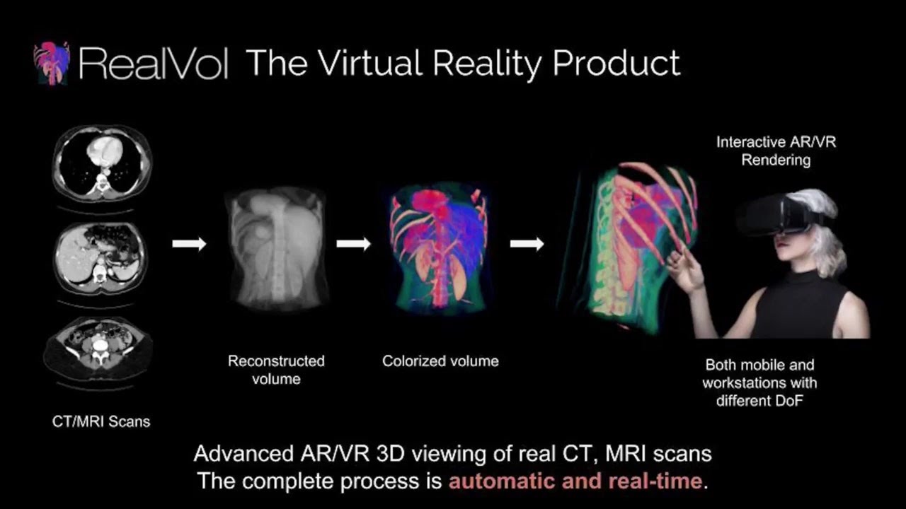 RealVol - Use CT, MRI scans in 3D Virtual Reality - YouTube