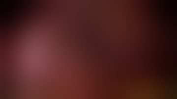 Laparoscopic Left Lateral Segmentectomy for Intrahepatic Cholangiocarcinoma