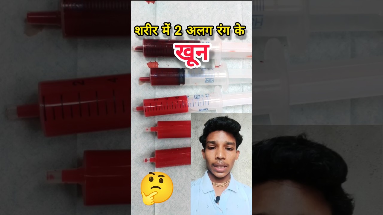 why arterial and venous blood colour are different 🤔 