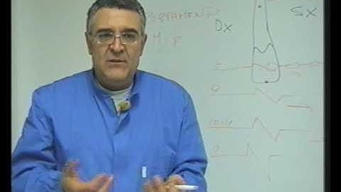 Modeling and Bending Wires - Uprighting and conclusions