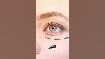 هل عمليات التجميل فقط تجميلية وليست علاجية 