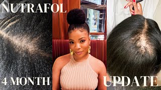 My Experience Taking Nutrafol (With Pictures) 4 Month Update #Nutrafol #hairgrowth #alopecia