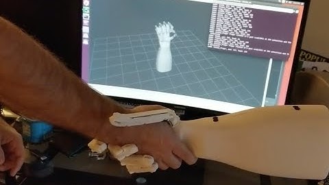 The Dexi Robot Hand - A Biomimetic robotic hand system for amputees