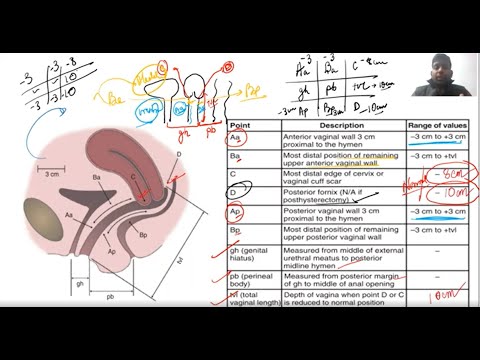 Basics of Urogynecology || Anatomy of Pelvis||Pelvic Organ Prolapse || POP -Q || MCh Urology