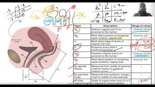 Basics of Urogynecology || Anatomy of Pelvis||Pelvic Organ Prolapse || POP -Q || MCh Urology