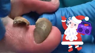 Christmas Nails and Christmas Music