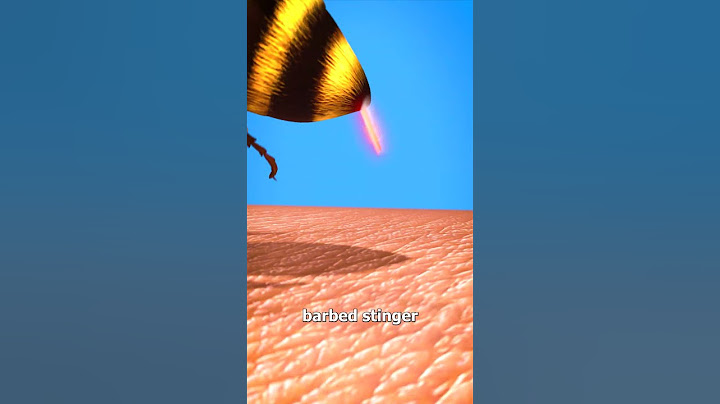 Why Bees Die After They Sting You 😳