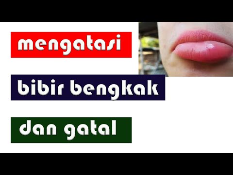 CARA MENGATASI BIBIR BENGKAK DAN GATAL || alergi, gigitan serangga, luka