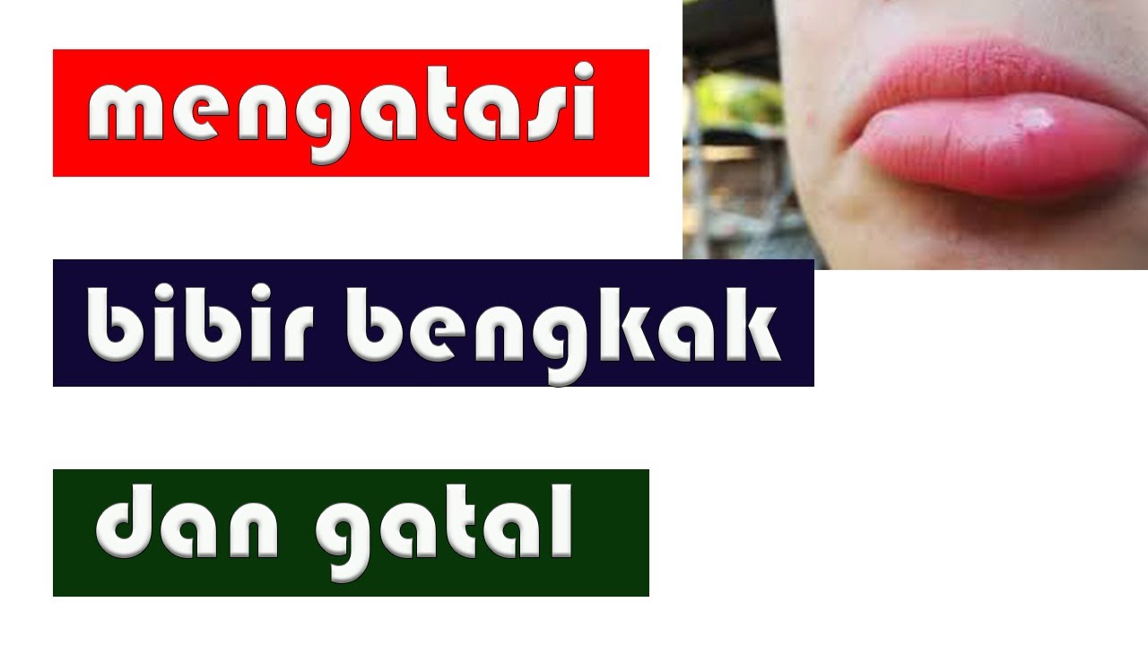 CARA MENGATASI BIBIR BENGKAK DAN GATAL || alergi, gigitan serangga