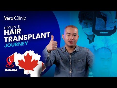 Hair transplant journey to Turkey from Canada