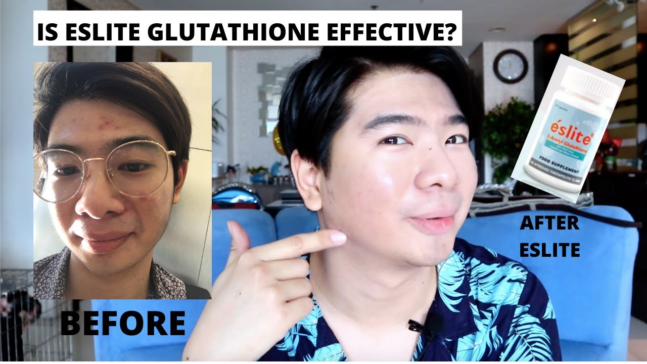 ESLITE S-ACETYL GLUTATHIONE REVIEW | ALTERNATIVE TO IV THERAPY | PUMUTI ...