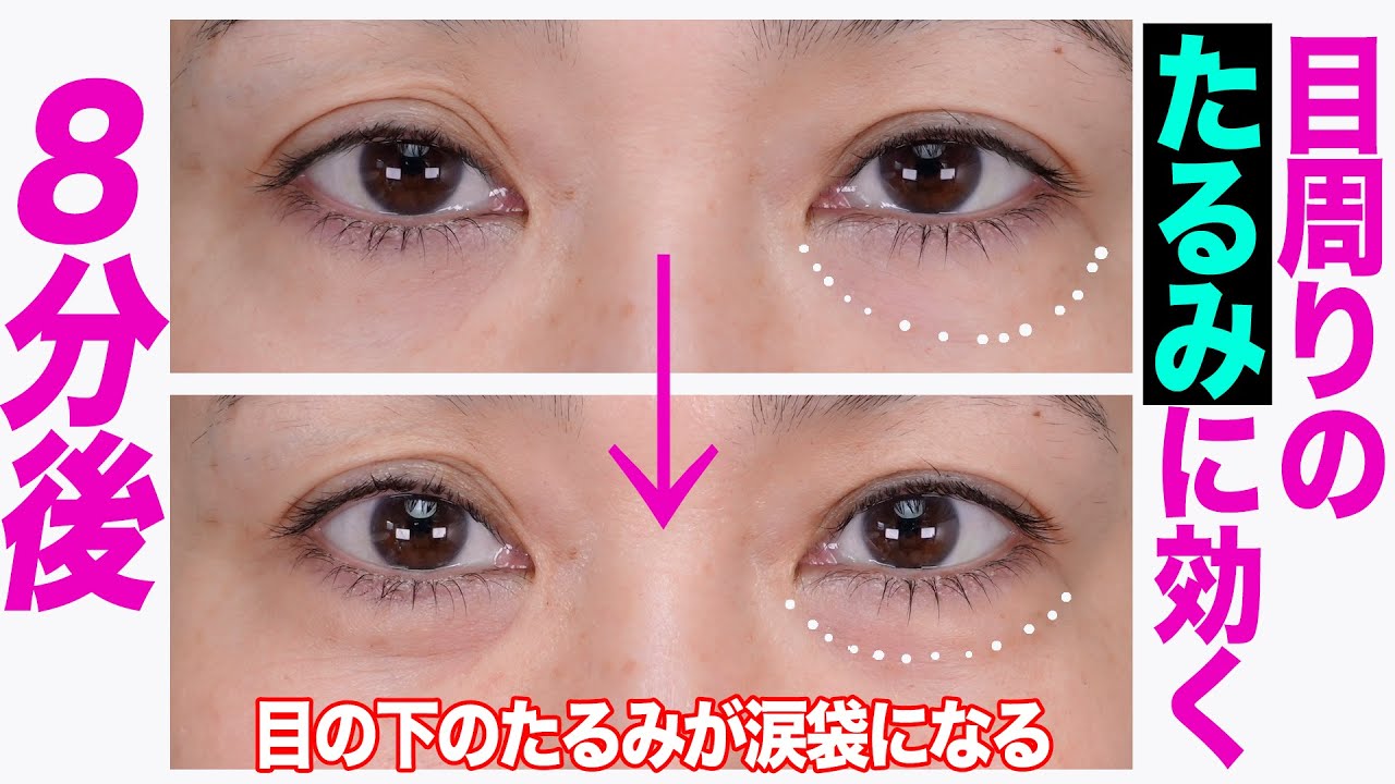 【目周りのたるみに効く】ほぐしとトレーニング