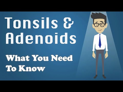 Tonsils and Adenoids - What You Need To Know