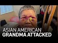 Asian American Grandmother Recovering After Being Attacked in San Francisco