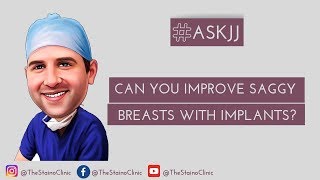 Can you improve saggy breasts with implants alone?