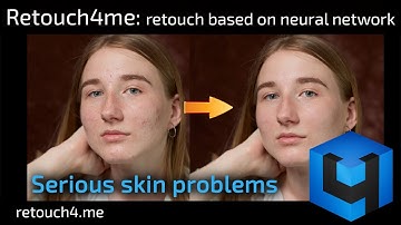 Retouch4me: retouch based on neural network. Serious skin problems