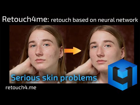 Retouch4me: retouch based on neural network. Serious skin problems