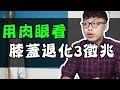 用肉眼就能看出，代表你膝蓋退化的三種徵兆｜你不知道的冷姿勢【三個字SunGuts】