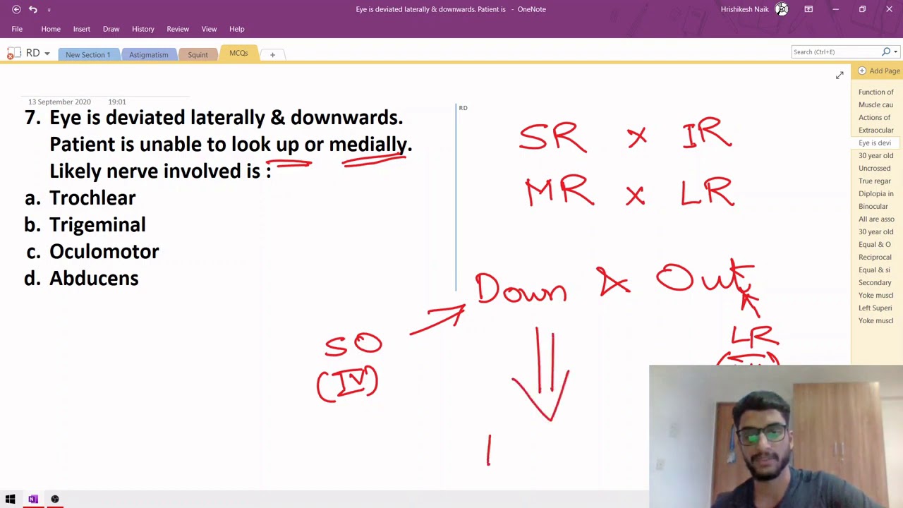 Косоглазие: основные понятия, вопросы и обсуждение