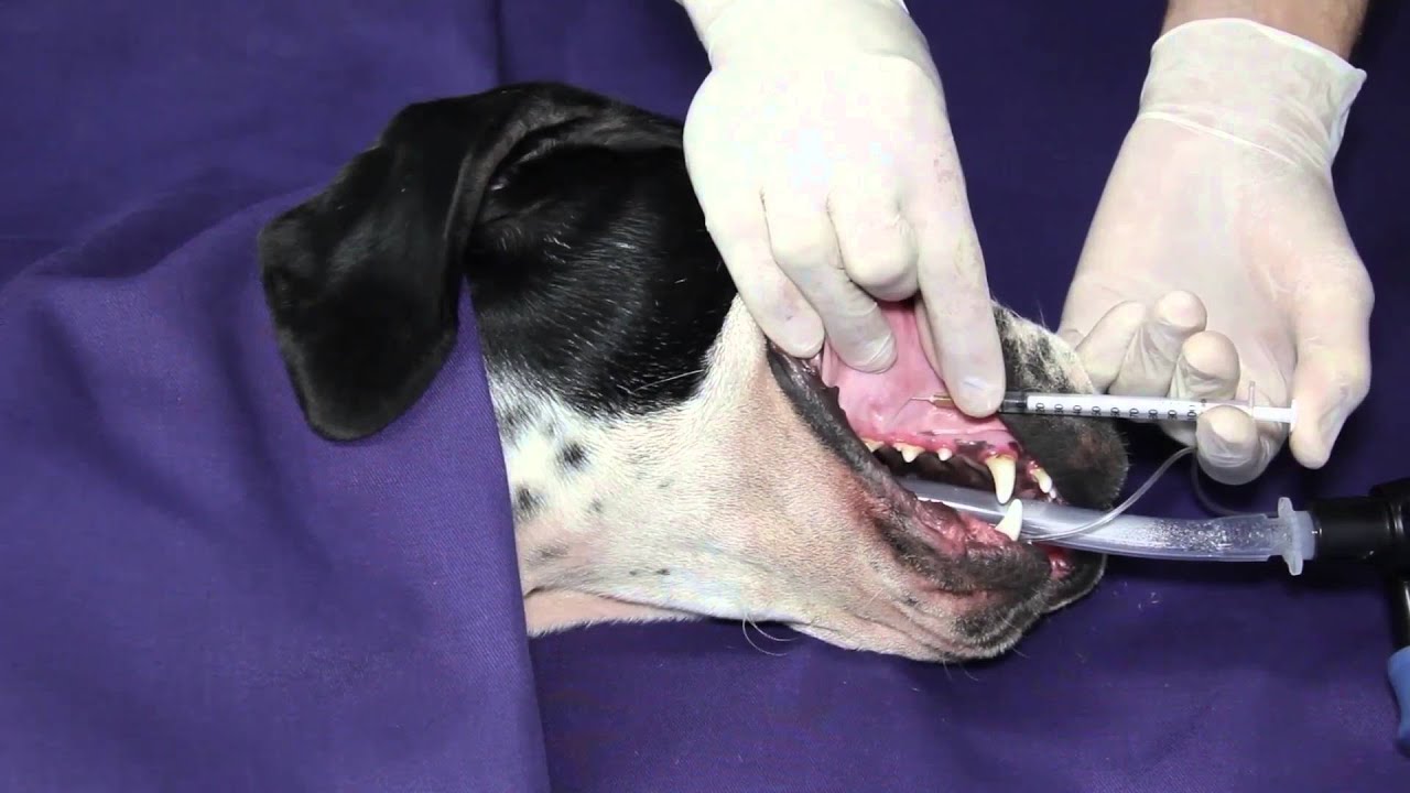 Infraorbital Nerve Block YouTube